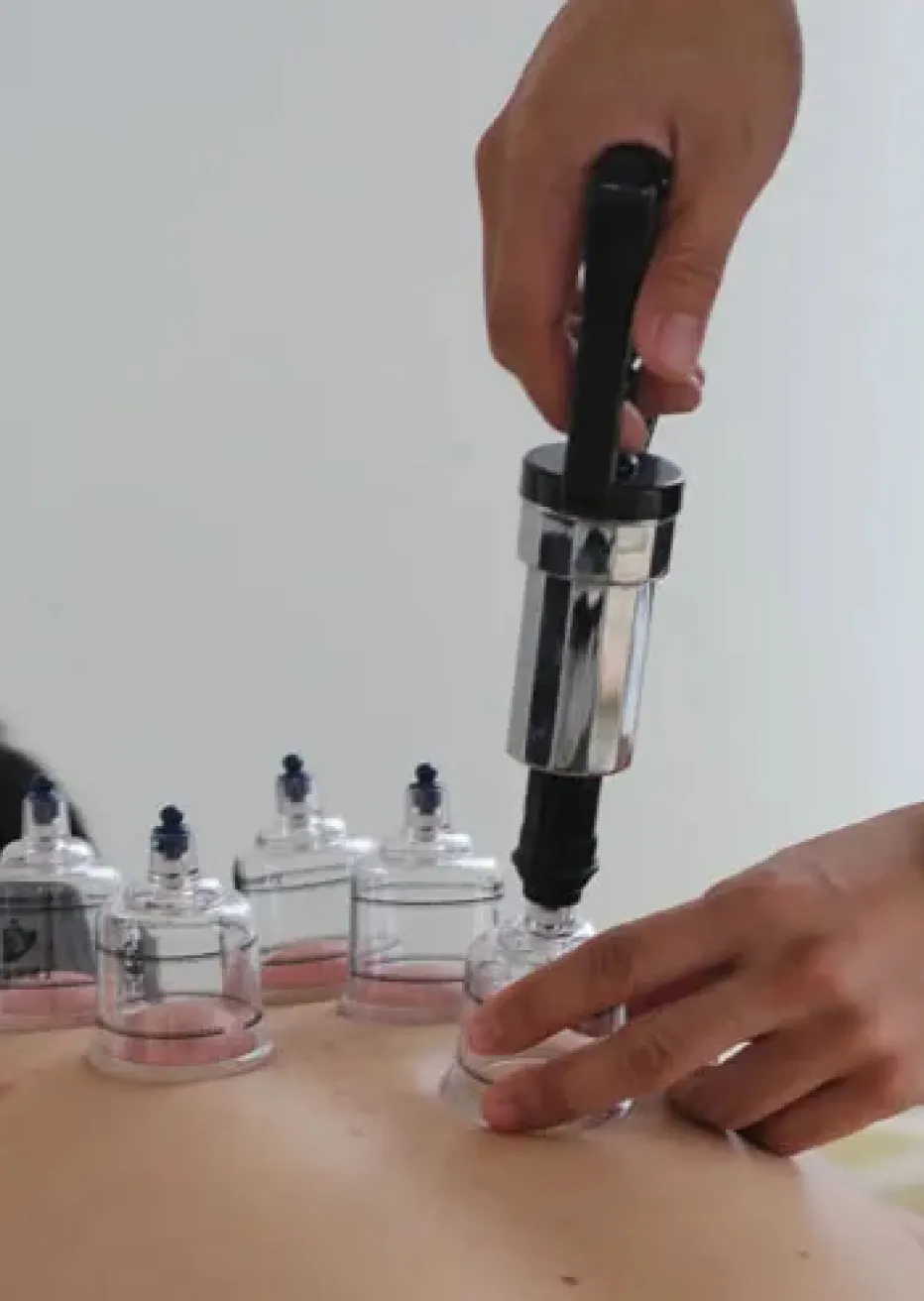 At Hyper Health, we provide a wide range of cupping therapies clinically proven to relieve pain